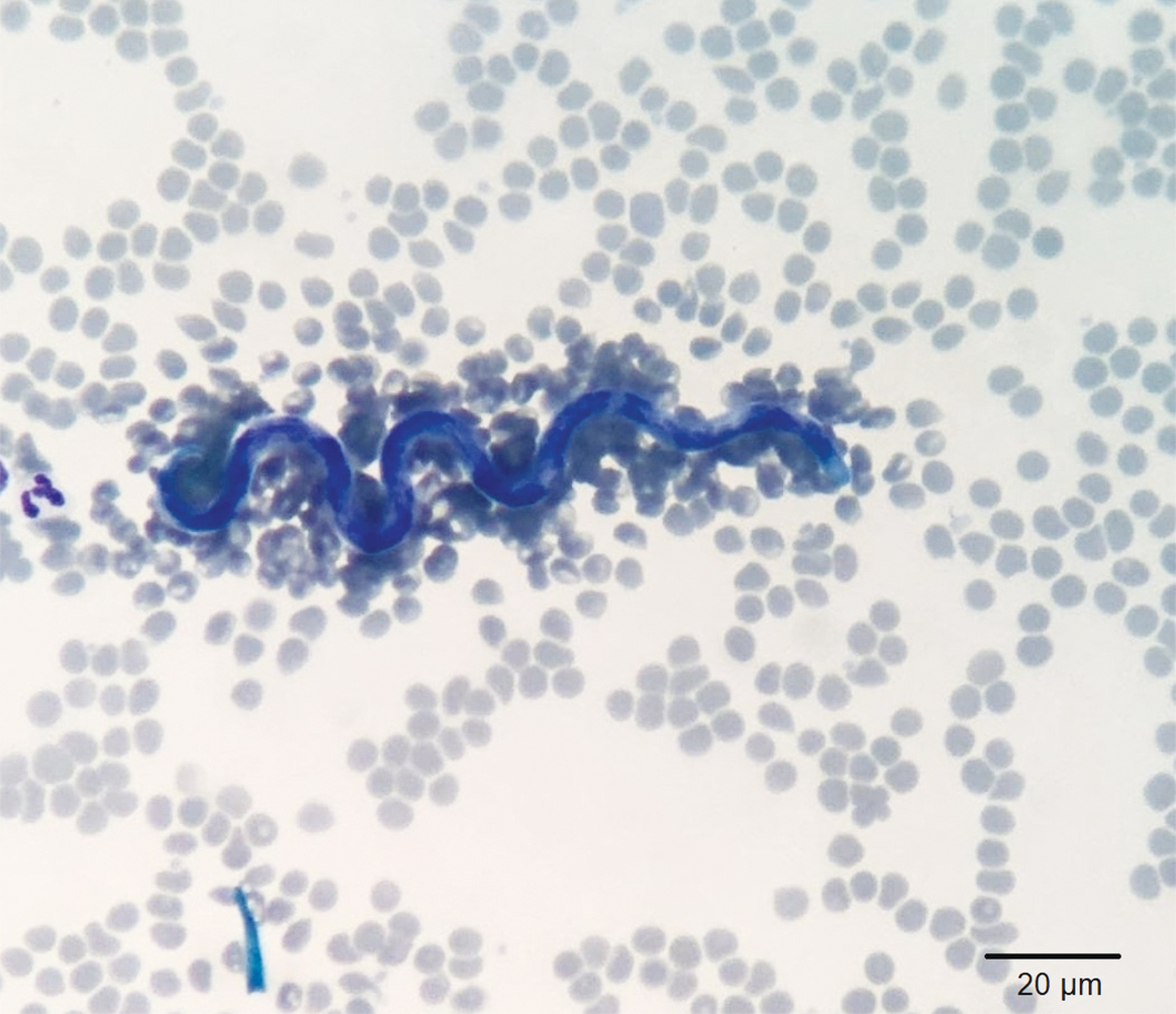 Esfregaço sanguíneo corado pelo método Romanovski, evidenciando a presença de microfilária de D. immitis. 400 x. Créditos: Jéssica Caroline Marochi 