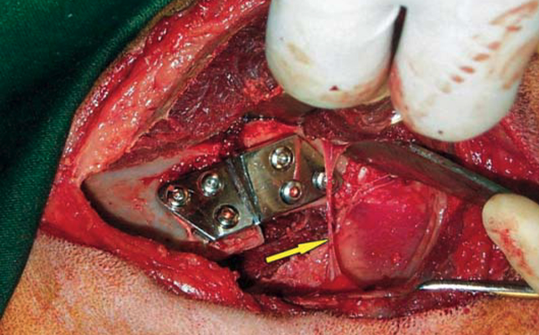 Créditos: Amaro Fábio - Projeto de Extensão em Ortopedia e Neurocirurgia - UFRPE 